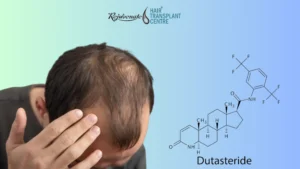 obat rambut rontok parah di apotik