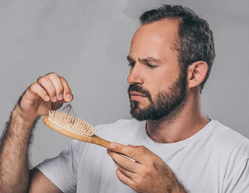 rambut rontok akibat penyakit autoimun