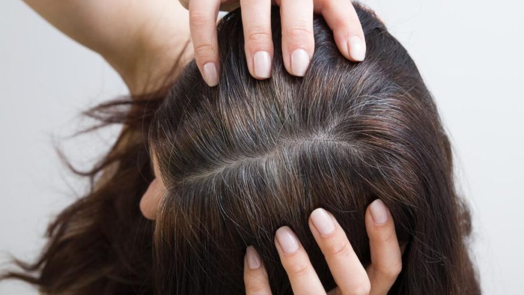 rambut berminyak
