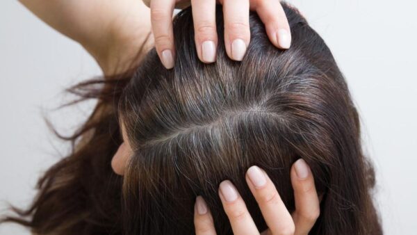 rambut berminyak