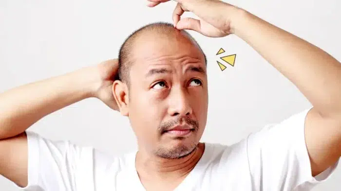 pria bertanya apa penyebab rambut rontok saya