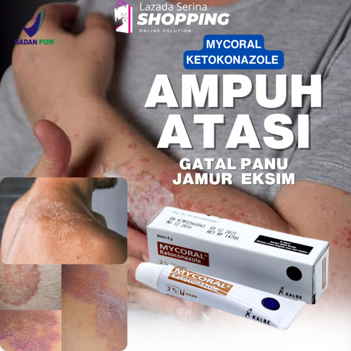 obat mycoral untuk infeksi jamur