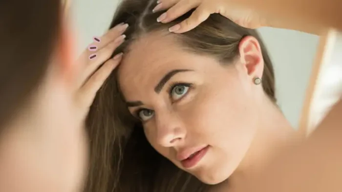 rambut botak bagian depan